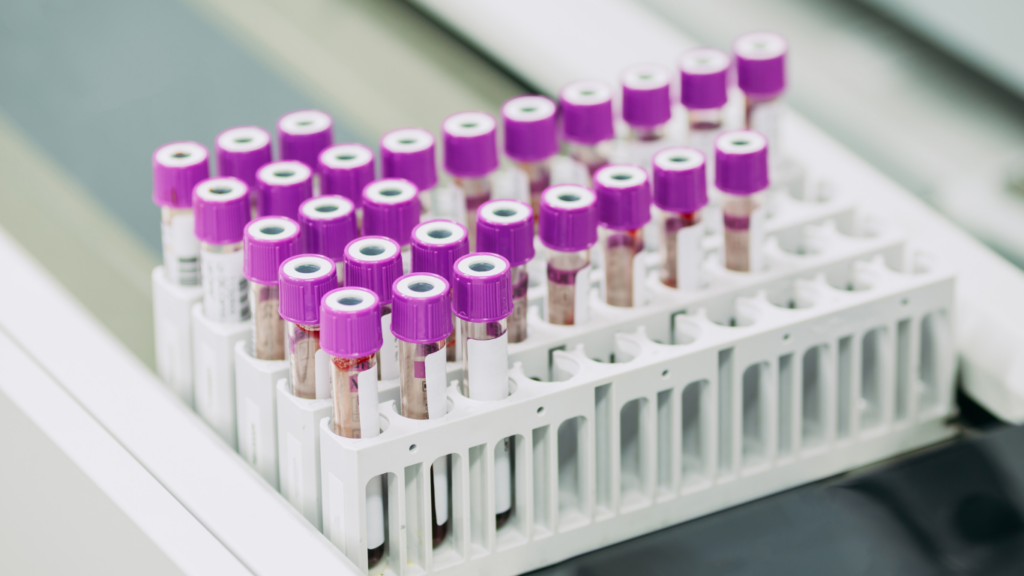 Purple laboratory vials full of blood